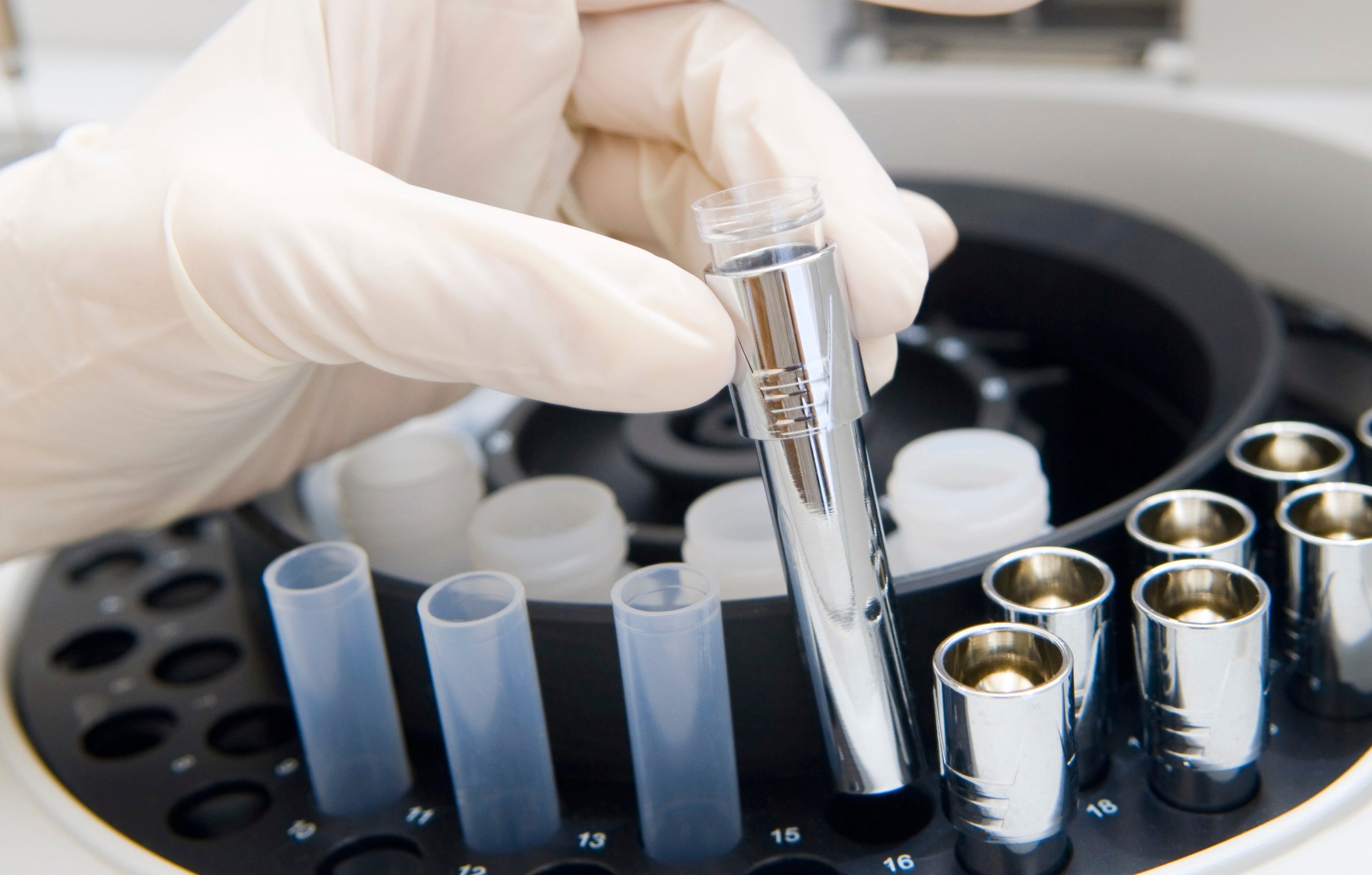 Analyzer_Confirmation Drug Testing